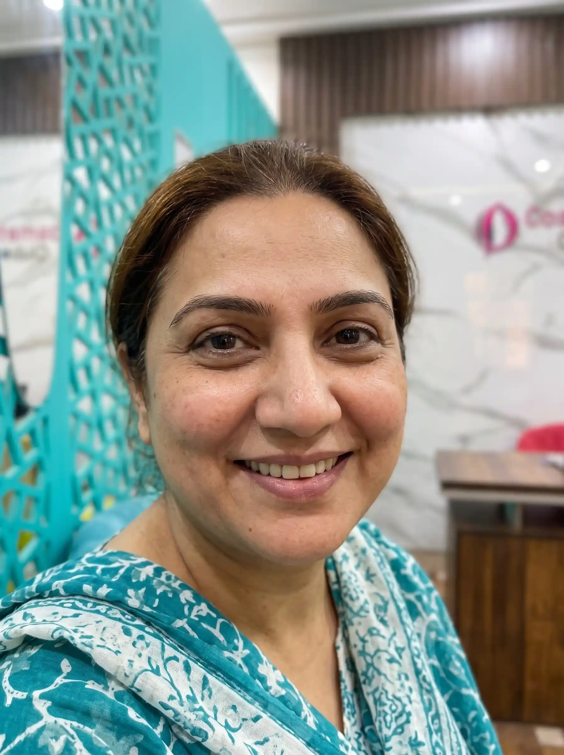 Eyelid Surgery Result